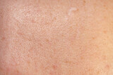 Skin texture and scar. Close-up stock photo of human skin in best quality.