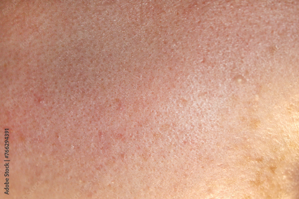 Fototapeta premium Texture of natural female skin close-up. Stock photo of the body in the best quality.