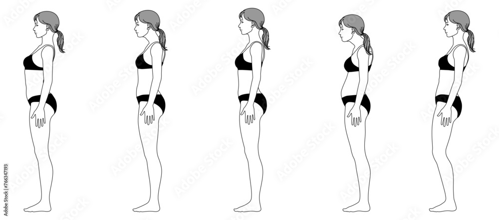 女性の正しい姿勢と悪い姿勢の比較イラストセット 猫背やストレートネックを示す全身横向き図解
