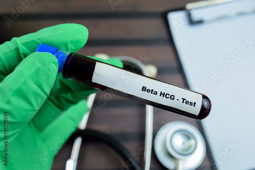 Beta HCG - Test with blood sample on wooden background. Healthcare or medical concept photo