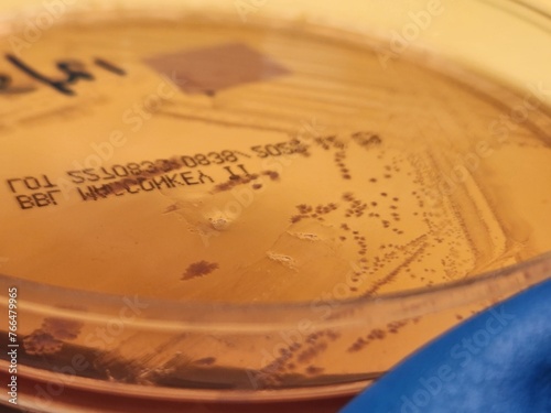 Petri dish with clear colonies of Shigella flexneri