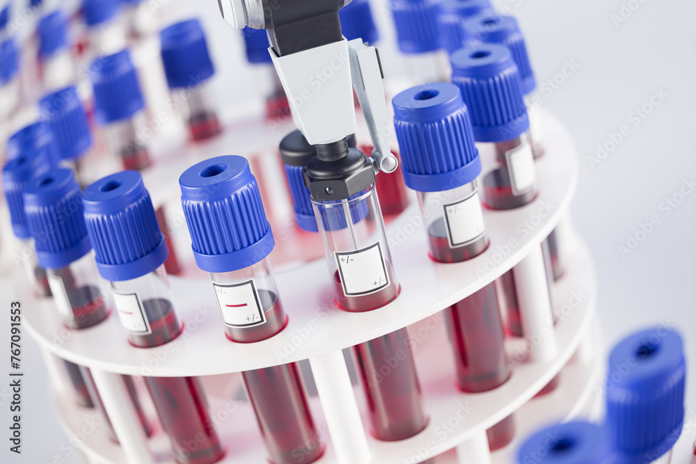 Advanced Robotic Automation in Clinical Laboratory Blood Sample Analysis