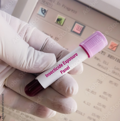 Blood sample for Insecticide Exposure Panel test, to diagnosis of organophosphate pesticides. photo