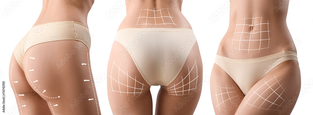 Young women with cellulite on white background - obrazy, fototapety, plakaty 