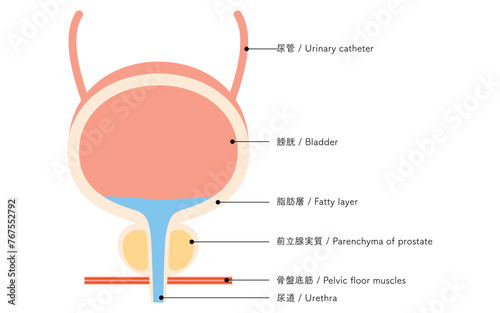 前立腺の医療イラスト、前立腺と膀胱