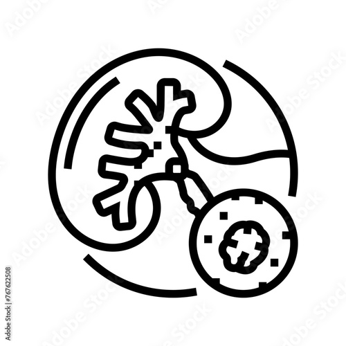 urolithiasis urology line icon vector. urolithiasis urology sign. isolated contour symbol black illustration