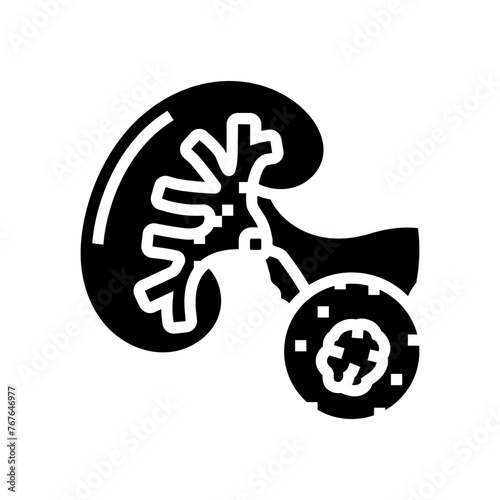 urolithiasis urology glyph icon vector. urolithiasis urology sign. isolated symbol illustration