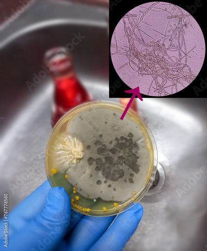 Malt Extract Agar in Petri dish using for growth media to isolate and cultivate yeasts, molds and fungal testing from neil scraping samples. Neil scraping for fungus culture with microscopy. photo