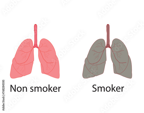 Smoker's lungs and healthy lungs. smoker and non smoker lungs. Vector illustration.