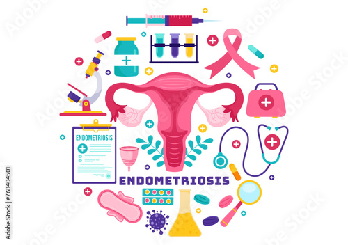 Endometriosis Vector Illustration with Condition the Endometrium Grows Outside the Uterine Wall in Women for Treatment in Flat Cartoon Background