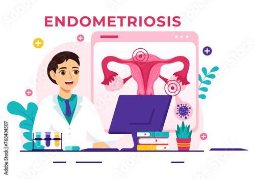 Endometriosis Vector Illustration with Condition the Endometrium Grows Outside the Uterine Wall in Women for Treatment in Flat Cartoon Background