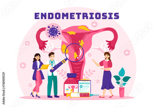 Endometriosis Vector Illustration with Condition the Endometrium Grows Outside the Uterine Wall in Women for Treatment in Flat Cartoon Background