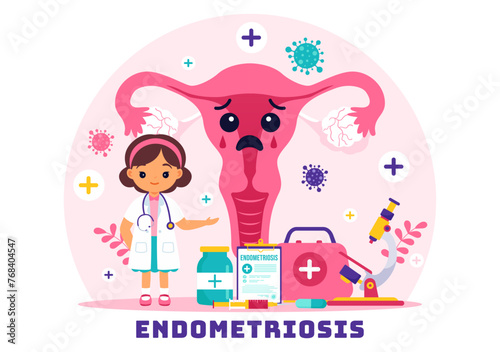 Endometriosis Vector Illustration with Condition the Endometrium Grows Outside the Uterine Wall in Women for Treatment in Flat Cartoon Background