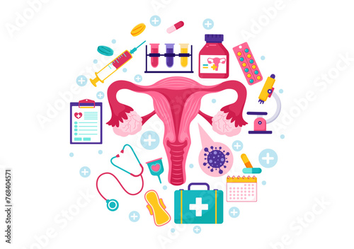 Endometriosis Vector Illustration with Condition the Endometrium Grows Outside the Uterine Wall in Women for Treatment in Flat Cartoon Background