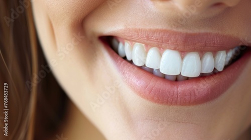 Beautiful Woman Smile With White Teeth. Concept of Teeth Whitening  Dental Health and Lip Care.