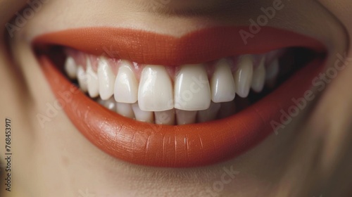 Beautiful Woman Smile With White Teeth. Concept of Teeth Whitening, Dental Health and Lip Care.