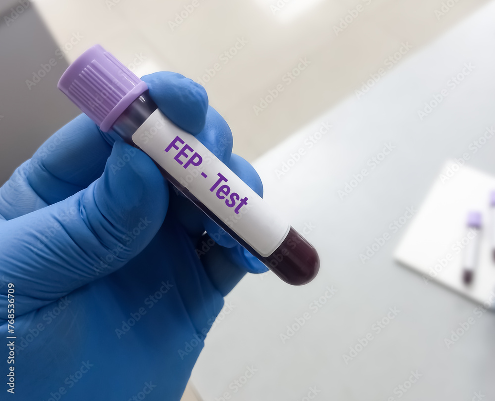 Blood sample tube for FEP or Free erythrocyte protoporphyrin test Blood sample tube for FEP or Free erythrocyte protoporphyrin test