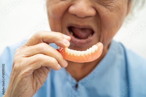 Asian elderly woman patient holding to use denture  healthy strong medical concept.