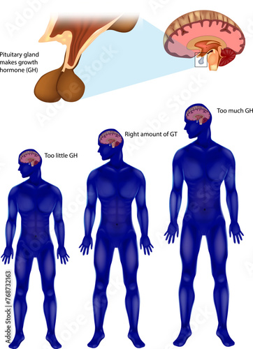 Endocrine regulation of growth. Pituitary gland makes growth hormone GH. Growth hormone or somatotropin, also known as human growth hormone hGH or HGH in its human. 