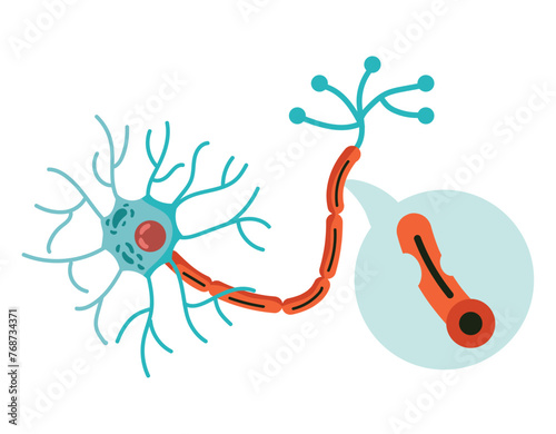 parkinson neural disease
