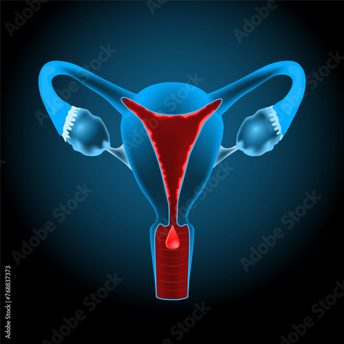 Uterine bleeding. Menstruation