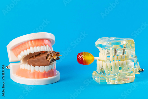 Two mock-ups of dental jaws with a lollipop and a chocolate bar on a blue background. The concept of the destructive effect on tooth enamel and teeth after eating sweets. Caries and pulpitis photo