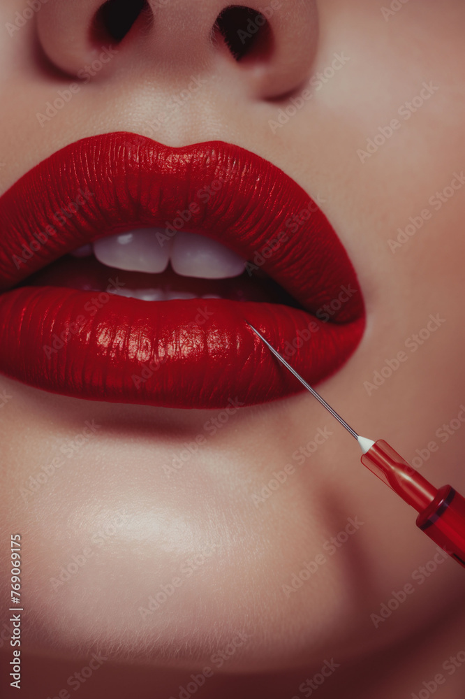 Obraz premium Luscious bright red lips part slightly as a syringe administers cosmetic filler, embodying beauty enhancement and personal care, cosmetic procedures.