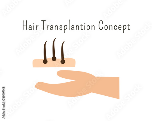 Human organ donation for transplantation concept with hand, suitable for medical banner, infographics and education. Hair transplantation concept. organ donation concept. 
