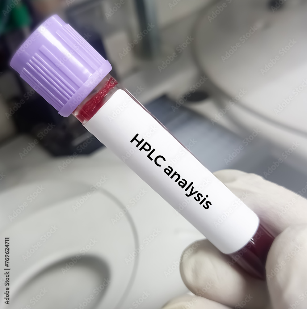 Blood sample tube for Hemoglobin variant analysis HPLC test, to