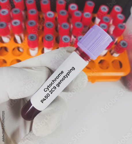 Blood sample for Cytochrome P450 2C9 genotyping test. CYP2C9 genotyping. photo