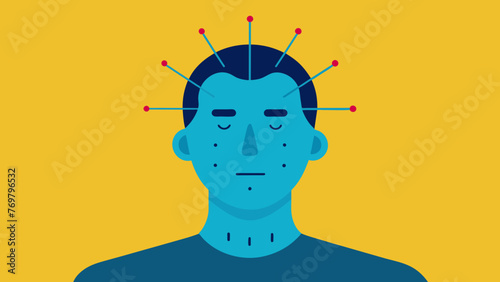  Closeup of a patients serene face with several needles protruding from pressure points on the forehead and as they relax into the theutic