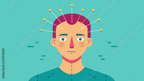  A persons face with tiny needles protruding from several points on their forehead used to release tension and promote relaxation.