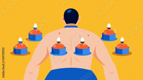  A cupping session in progress showing multiple glass cups suctioned onto the clients back.