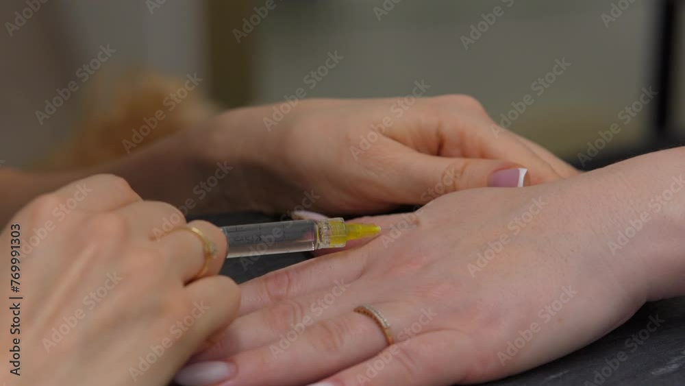 The cosmetologist makes an injection of a medicine for skin rejuvenation on a woman's hand. The cosmetologist makes an injection of a medicine for skin rejuvenation on a woman's hand.