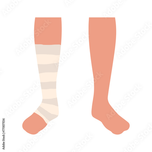 Injured ankle with bandage