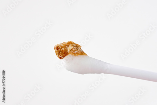 Ear wax plug isolated on white background. Removed giant ear wax plug on cotton swab closeup. Wax, which is also called cerumen on swab, macro shot. Cotton swab and ear hygiene. Remove earwax buildup