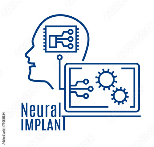 Implantation of a neural chip into the human brain.