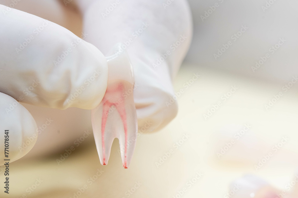 Naklejka premium tooth endodontics