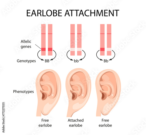 Fotografie Attached earlobe and free earlobe