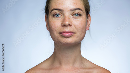 Beautiful girl with freckles shows emotions in front of the camera on a white background