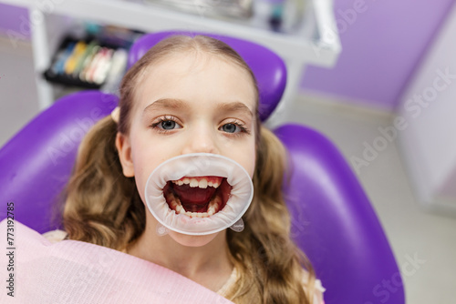 Fotografie girl with an oral dilator at a dentist appointment