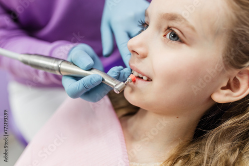 The process of using a dental brush during the stages of a professional teeth cleaning procedure in a clinic