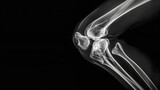 Un aperçu révélateur : une radiographie détaillée révèle les subtilités de l'articulation et de la jambe du genou humain sur un fond bleu serein