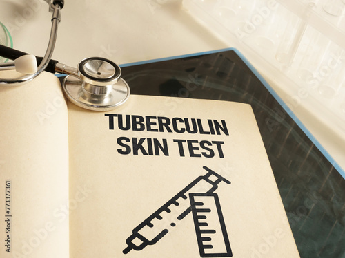Tuberculin skin test is shown using the text photo