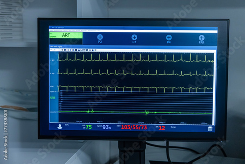Modern equipment with vital signs monitors in operating room of contemporary clinic. Cardiogram signal monitoring process. The patient's vital signs are displayed on the screen. ECG, ECG curves.