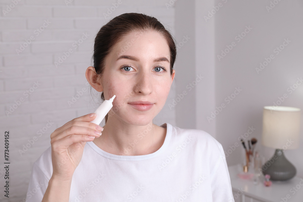 Woman with acne problem applying cream at home Woman with acne problem applying cream at home