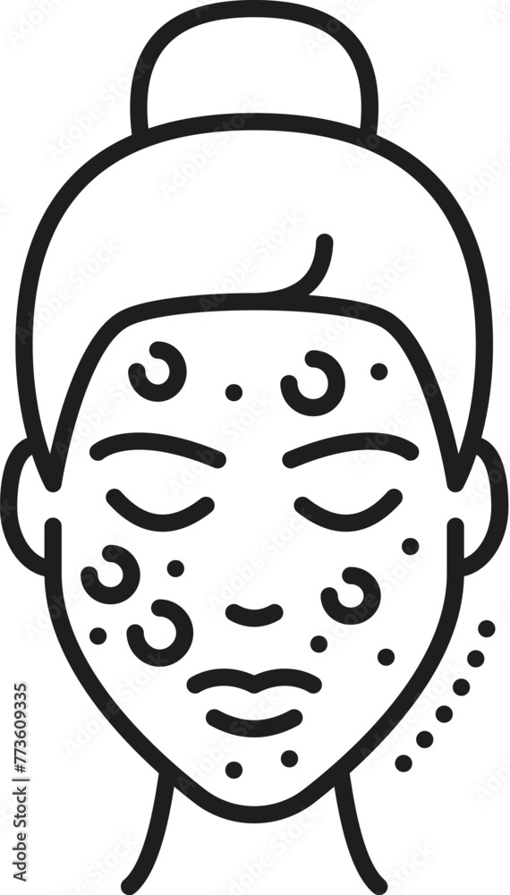 Face care cosmetology and mesotherapy, skin acne pimple, skincare health line icon. Facial skin health problem treatment and skincare cosmetics outline vector symbol with woman face covered acne Face care cosmetology and mesotherapy, skin acne pimple, skincare health line icon. Facial skin health problem treatment and skincare cosmetics outline vector symbol with woman face covered acne