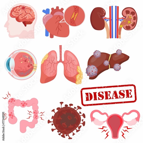 Illness of various body systems  internal organs