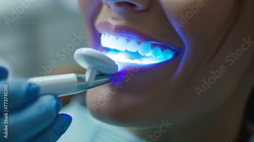 Dental Patient Undergoing Teeth Whitening Procedure