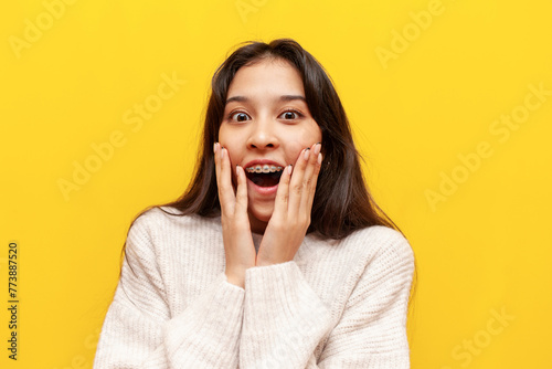 young shocked asian girl with braces wonders on yellow isolated background, amazed korean girl looks at camera with open mouth